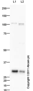 Western blot - Anti-UCP2 antibody (AB97931)