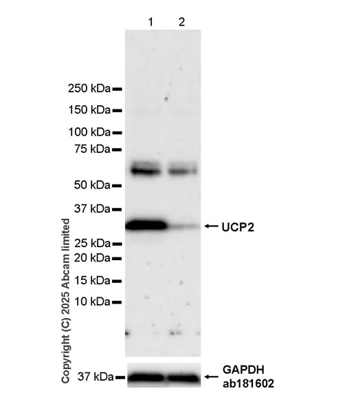 Western blot - Anti-UCP2 antibody [EPR30577-749] (AB325426)