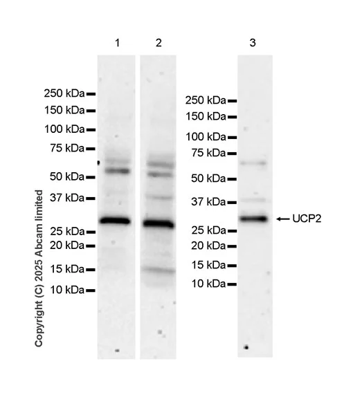 Western blot - Anti-UCP2 antibody [EPR30577-749] (AB325426)