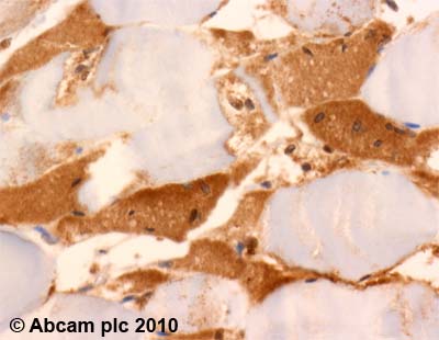 Immunohistochemistry (Formalin/PFA-fixed paraffin-embedded sections) - Anti-UCP3 antibody (AB10985), expandable thumbnail