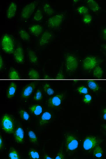 Immunocytochemistry/ Immunofluorescence - Anti-UCP3 antibody (AB180643)