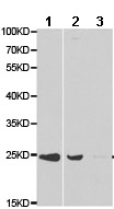 Western blot - Anti-UCP3 antibody (AB180643), expandable thumbnail