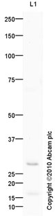Western blot - Anti-UCP3 antibody [mAbcam61299] (AB61299), expandable thumbnail