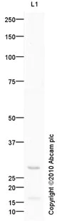 Western blot - Anti-UCP3 antibody [mAbcam61299] (AB61299)