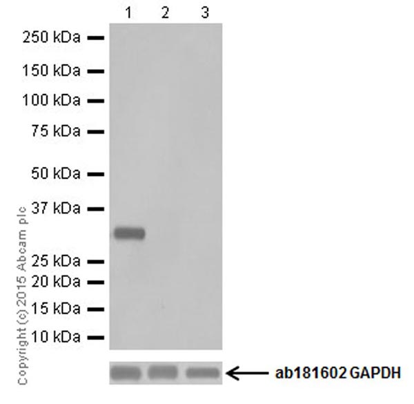 Western blot - Anti-UCP3 + UCP1 antibody [EPR19006] (AB193470), expandable thumbnail