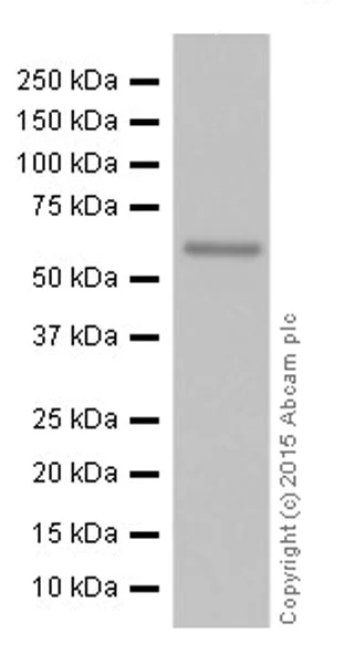 Western blot - Anti-UCP3+UCP1 antibody [EPR19006] - BSA and Azide free (AB251173)