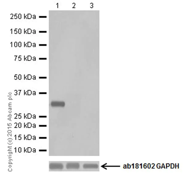 Western blot - Anti-UCP3+UCP1 antibody [EPR19006] - BSA and Azide free (AB251173)