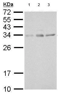 Western blot - Anti-UCP4 antibody (AB183886)