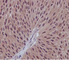 Immunohistochemistry (Formalin/PFA-fixed paraffin-embedded sections) - Anti-UFC1 antibody [EPR15014-102] (ab189252), expandable thumbnail