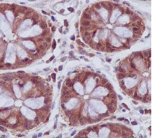 Immunohistochemistry (Formalin/PFA-fixed paraffin-embedded sections) - Anti-UFC1 antibody [EPR15014-102] (AB189252), expandable thumbnail