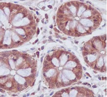 Immunohistochemistry (Formalin/PFA-fixed paraffin-embedded sections) - Anti-UFC1 antibody [EPR15014-102] (AB189252)