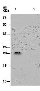Immunoprecipitation - Anti-UFC1 antibody [EPR15014-102] (ab189252), expandable thumbnail