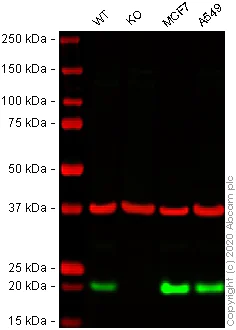 Western blot - Anti-UFC1 antibody [EPR15014-102] (AB189252)
