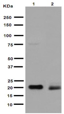 Western blot - Anti-UFC1 antibody [EPR15014-102] (AB189252), expandable thumbnail