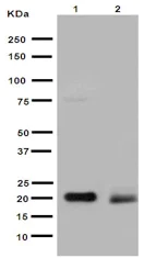 Western blot - Anti-UFC1 antibody [EPR15014-102] (AB189252)