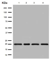 Western blot - Anti-UFC1 antibody [EPR15014-102] (AB189252)