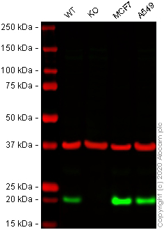 Western blot - Anti-UFC1 antibody [EPR15014-102] - BSA and Azide free (AB250984), expandable thumbnail