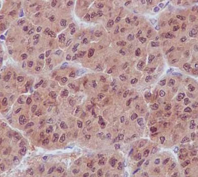 Immunohistochemistry (Formalin/PFA-fixed paraffin-embedded sections) - Anti-UFC1 antibody [EPR15014] (ab189251), expandable thumbnail