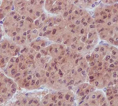 Immunohistochemistry (Formalin/PFA-fixed paraffin-embedded sections) - Anti-UFC1 antibody [EPR15014] (AB189251)