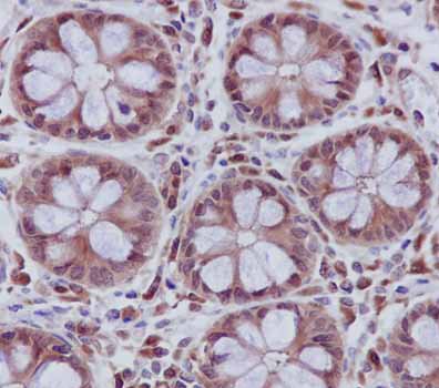 Immunohistochemistry (Formalin/PFA-fixed paraffin-embedded sections) - Anti-UFC1 antibody [EPR15014] (AB189251), expandable thumbnail