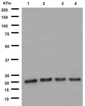 Western blot - Anti-UFC1 antibody [EPR15014] (AB189251), expandable thumbnail