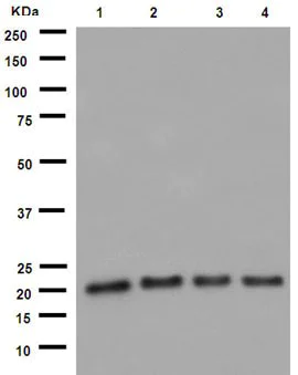 Western blot - Anti-UFC1 antibody [EPR15014] (AB189251)
