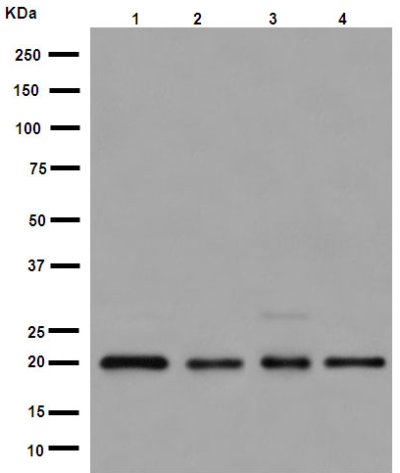 Western blot - Anti-UFC1 antibody [EPR15014] (AB189251), expandable thumbnail