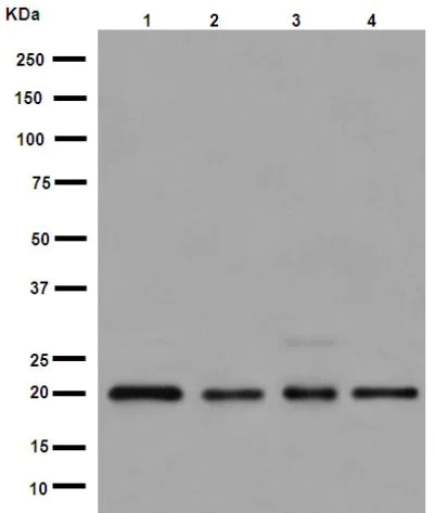 Western blot - Anti-UFC1 antibody [EPR15014] (AB189251)