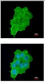 Immunocytochemistry/ Immunofluorescence - Anti-UFD1L antibody (AB96648)