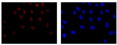 Immunocytochemistry/ Immunofluorescence - Anti-UFSP2 antibody [EPR13424] (AB185965), expandable thumbnail