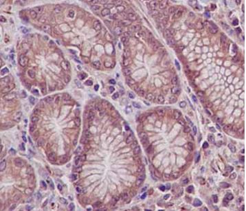 Immunohistochemistry (Formalin/PFA-fixed paraffin-embedded sections) - Anti-UFSP2 antibody [EPR13424] (AB185965), expandable thumbnail