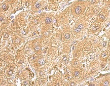 Immunohistochemistry (Formalin/PFA-fixed paraffin-embedded sections) - Anti-UGDH antibody (AB155005)