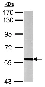 Western blot - Anti-UGDH antibody (AB155005)