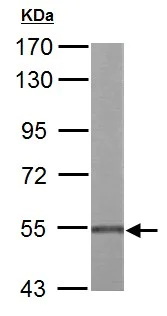 Western blot - Anti-UGDH antibody (AB155005)