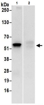 Immunoprecipitation - Anti-UGDH antibody (AB226172)