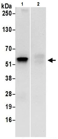 Immunoprecipitation - Anti-UGDH antibody (AB226172)