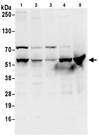 Western blot - Anti-UGDH antibody (AB226172)