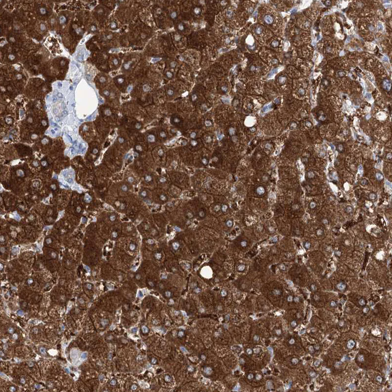 Immunohistochemistry (Formalin/PFA-fixed paraffin-embedded sections) - Anti-UGDH antibody (AB246999)