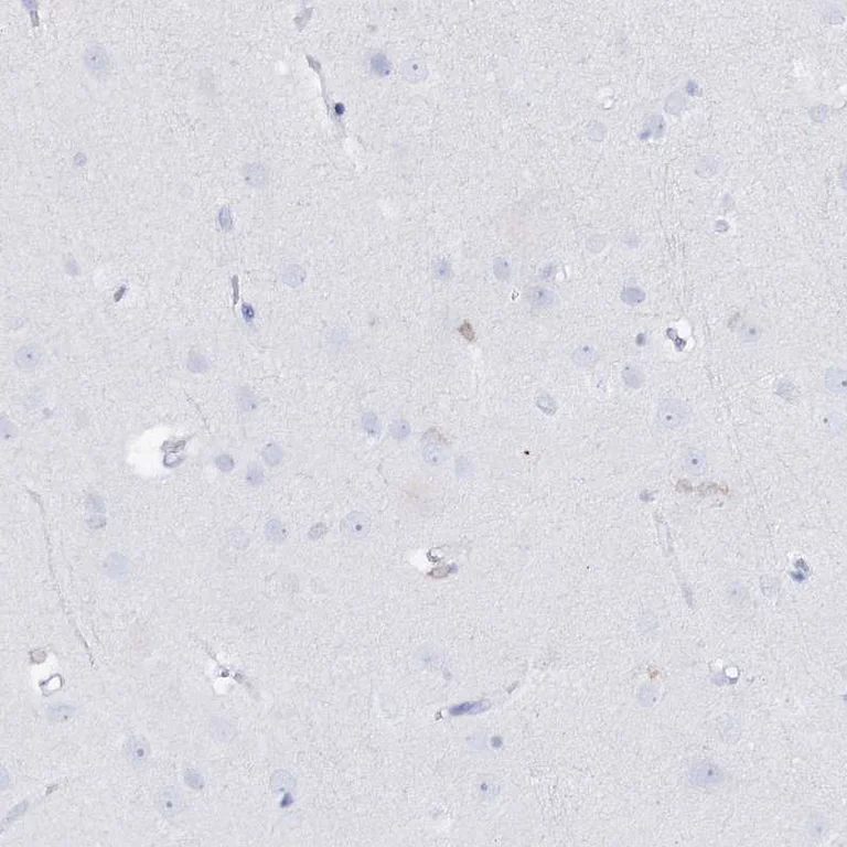 Immunohistochemistry (Formalin/PFA-fixed paraffin-embedded sections) - Anti-UGDH antibody (AB246999)
