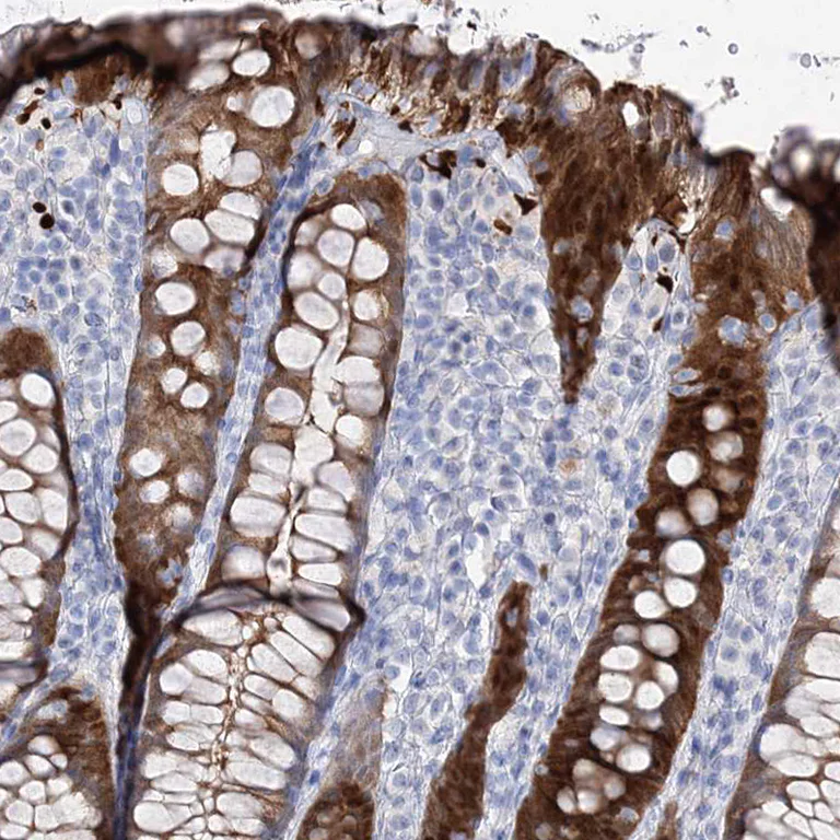 Immunohistochemistry (Formalin/PFA-fixed paraffin-embedded sections) - Anti-UGDH antibody (AB246999)