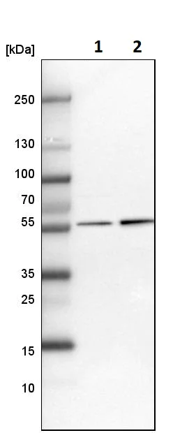Western blot - Anti-UGDH antibody (AB246999)
