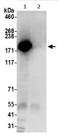 Immunoprecipitation - Anti-UGGT/UGT1 antibody (AB241357), expandable thumbnail