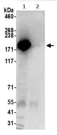 Immunoprecipitation - Anti-UGGT/UGT1 antibody (AB241357)