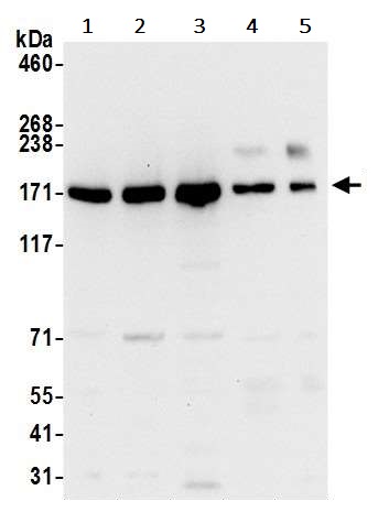Western blot - Anti-UGGT/UGT1 antibody (AB241357), expandable thumbnail