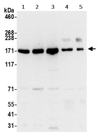 Western blot - Anti-UGGT/UGT1 antibody (AB241357)