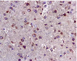 Immunohistochemistry (Formalin/PFA-fixed paraffin-embedded sections) - Anti-UGGT/UGT1 antibody [EPR5105] (AB124879)