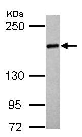 Western blot - Anti-UGGT2 antibody (AB154683), expandable thumbnail