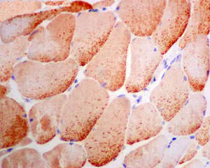 Immunohistochemistry (Formalin/PFA-fixed paraffin-embedded sections) - Anti-UGPase antibody [EPR10626] (AB157473)