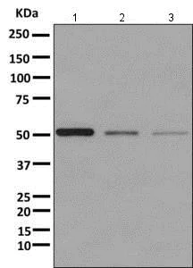 Western blot - Anti-UGPase antibody [EPR10626] (AB157473)