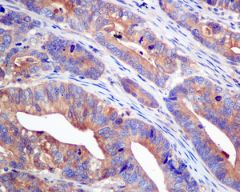 Immunohistochemistry (Formalin/PFA-fixed paraffin-embedded sections) - Anti-UGPase antibody [EPR10627(B)] (AB154817), expandable thumbnail